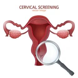 Breakthrough Cervical Cancer Treatment Reduces Mortality Rate by 40%: Lancet Study