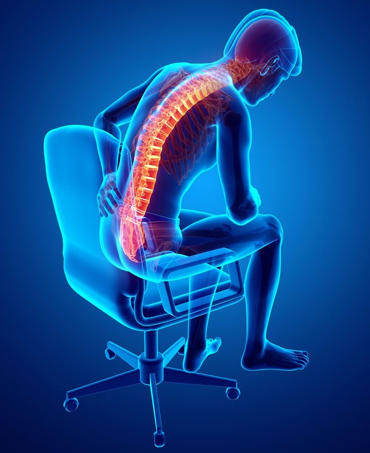 Break the Sitting Habit: New Research Offers Hope for Back Pain Sufferers