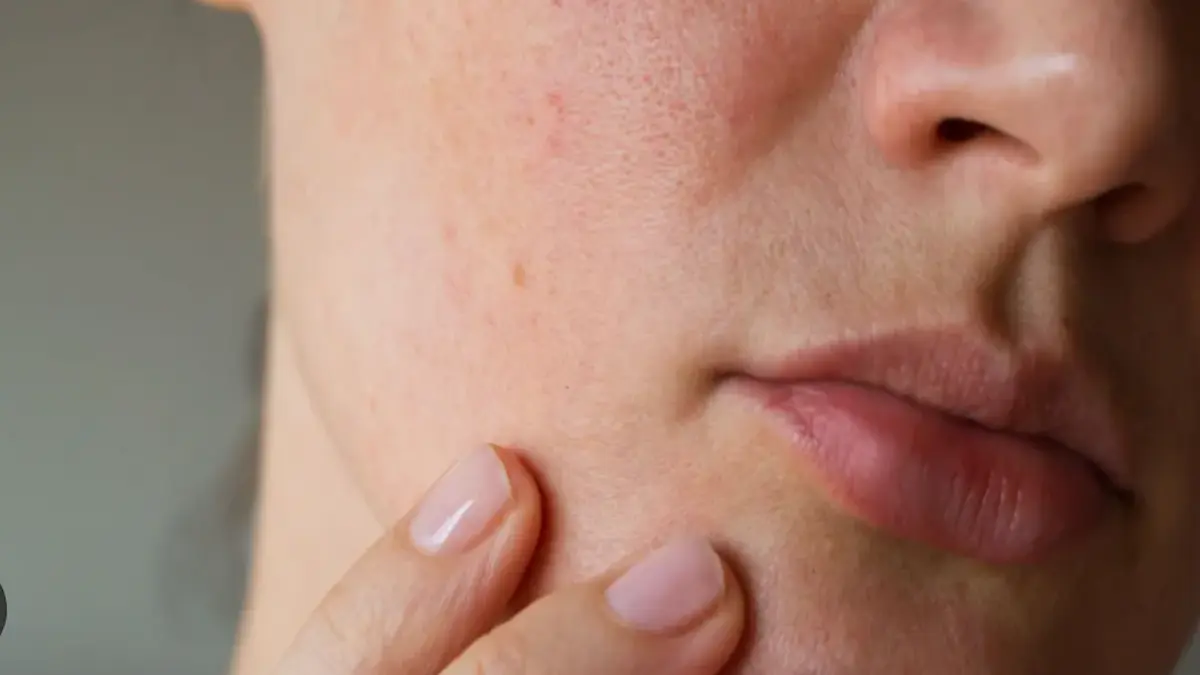 Skin barrier dysfunction: Causes, symptoms and treatment